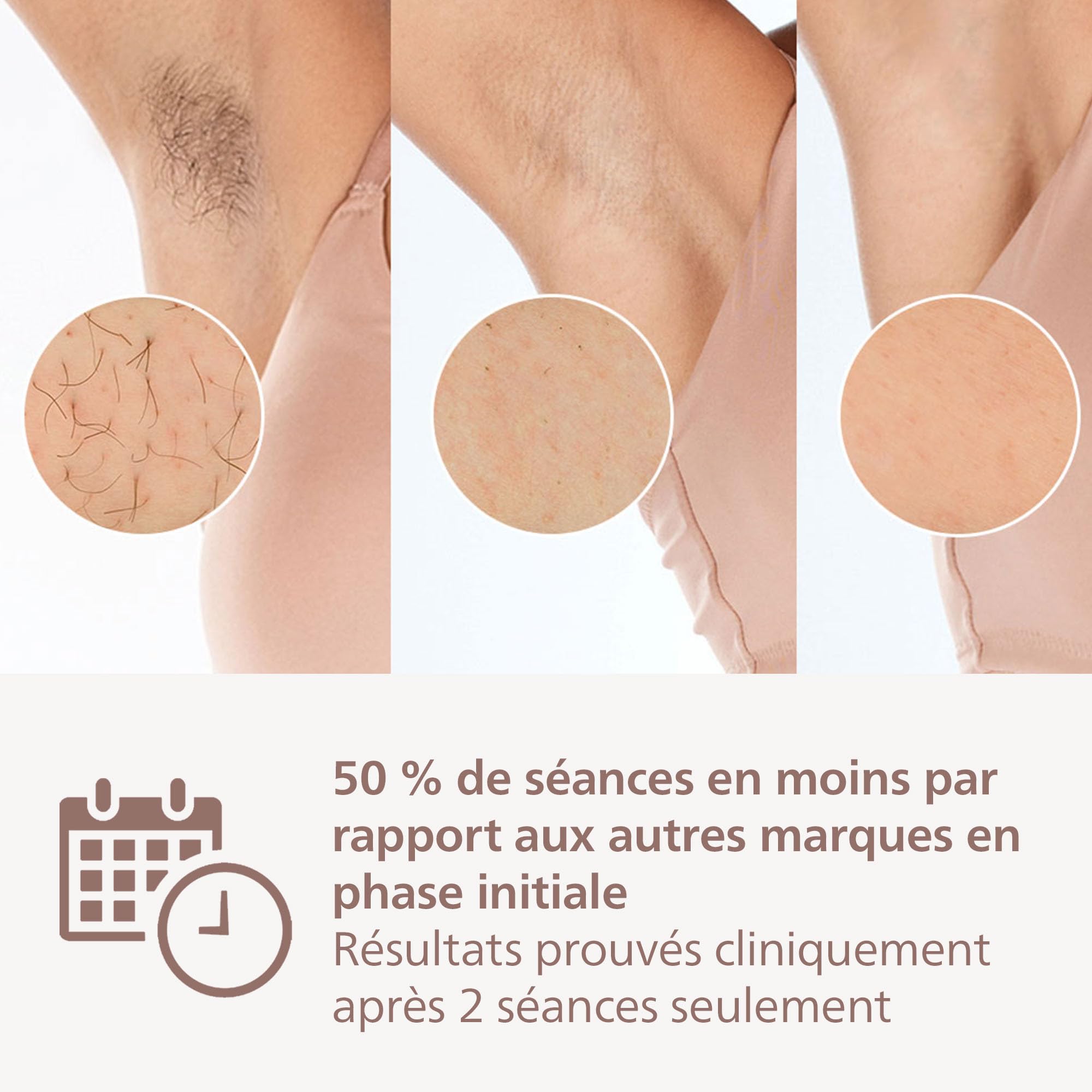 Philips Lumea Série 9900, épilateur à lumière pulsée, technologie SenseIQ et SkinAI, 4 embouts pour le corps, le visage, le maillot et les aisselles, utilisation avec et sans fil (modèle BRI951/00)